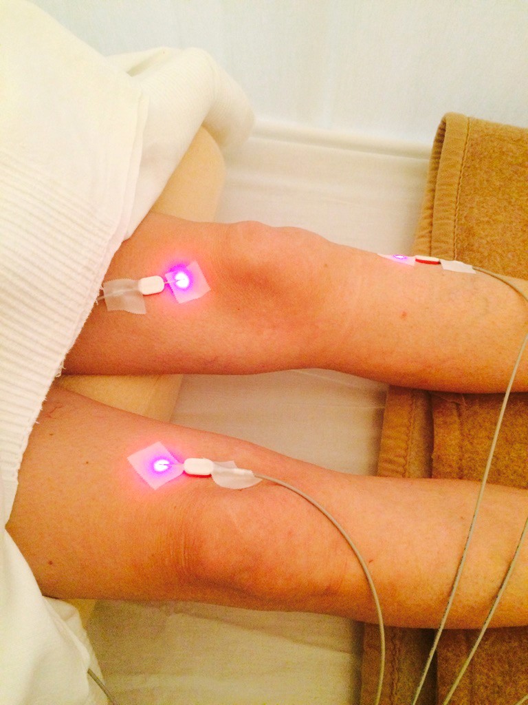 Laser Akupunktur Bein